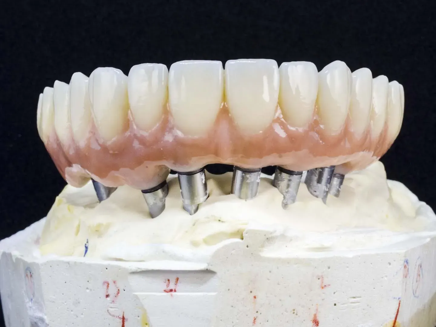 Implant-Supported Dentures Right Here in Newkirk, OK